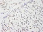 CPSF160 Antibody in Immunohistochemistry (Paraffin) (IHC (P))