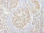 CPSF160 Antibody in Immunohistochemistry (Paraffin) (IHC (P))