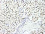 RCOR3 Antibody in Immunohistochemistry (Paraffin) (IHC (P))