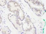 RCOR3 Antibody in Immunohistochemistry (Paraffin) (IHC (P))