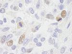 CENP-F/Mitosin Antibody in Immunohistochemistry (Paraffin) (IHC (P))