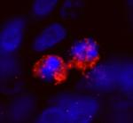 CENP-F/Mitosin Antibody in Immunohistochemistry (Paraffin) (IHC (P))