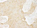 USP3 Antibody in Immunohistochemistry (Paraffin) (IHC (P))