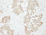 Pol Lambda Antibody in Immunohistochemistry (Paraffin) (IHC (P))