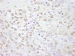 Pol Lambda Antibody in Immunohistochemistry (Paraffin) (IHC (P))