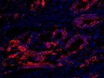 eEF2 Kinase Antibody in Immunohistochemistry (Paraffin) (IHC (P))