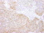 eEF2 Kinase Antibody in Immunohistochemistry (Paraffin) (IHC (P))