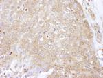 eEF2 Kinase Antibody in Immunohistochemistry (Paraffin) (IHC (P))