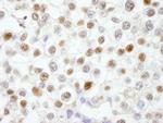 Fen1 Antibody in Immunohistochemistry (Paraffin) (IHC (P))