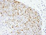 Fen1 Antibody in Immunohistochemistry (Paraffin) (IHC (P))