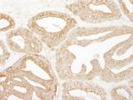 EPS15 Antibody in Immunohistochemistry (Paraffin) (IHC (P))