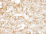 EPS15 Antibody in Immunohistochemistry (Paraffin) (IHC (P))