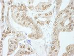 Cyclin E1 Antibody in Immunohistochemistry (Paraffin) (IHC (P))