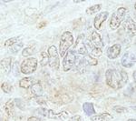 METTL3/MT-A70 Antibody in Immunohistochemistry (Paraffin) (IHC (P))