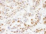 PHF8 Antibody in Immunohistochemistry (Paraffin) (IHC (P))