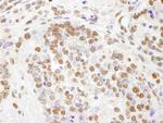 PHF8 Antibody in Immunohistochemistry (Paraffin) (IHC (P))