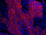 14-3-3 Sigma Antibody in Immunohistochemistry (Paraffin) (IHC (P))