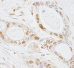 PUS1 Antibody in Immunohistochemistry (Paraffin) (IHC (P))