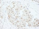 PUS1 Antibody in Immunohistochemistry (Paraffin) (IHC (P))