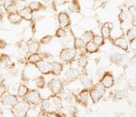 IRS2 Antibody in Immunohistochemistry (Paraffin) (IHC (P))