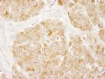 IRS1 Antibody in Immunohistochemistry (Paraffin) (IHC (P))