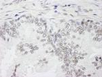 WTAP Antibody in Immunohistochemistry (Paraffin) (IHC (P))