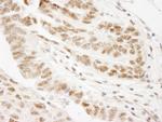 WTAP Antibody in Immunohistochemistry (Paraffin) (IHC (P))