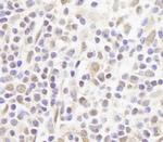 FOG1/ZFPM1 Antibody in Immunohistochemistry (Paraffin) (IHC (P))