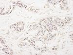 FOG1/ZFPM1 Antibody in Immunohistochemistry (Paraffin) (IHC (P))