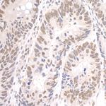 Paf1 Antibody in Immunohistochemistry (Paraffin) (IHC (P))