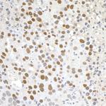 Paf1 Antibody in Immunohistochemistry (Paraffin) (IHC (P))