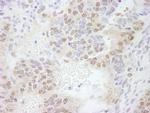 ERF Antibody in Immunohistochemistry (Paraffin) (IHC (P))