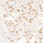 BRD4 Antibody in Immunohistochemistry (Paraffin) (IHC (P))