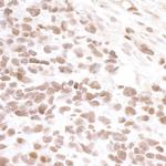 BRD4 Antibody in Immunohistochemistry (Paraffin) (IHC (P))