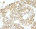 IQGAP1 Antibody in Immunohistochemistry (Paraffin) (IHC (P))