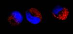 cAbl Antibody in Immunocytochemistry (ICC/IF)