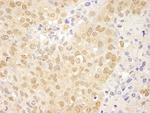 cAbl Antibody in Immunohistochemistry (Paraffin) (IHC (P))