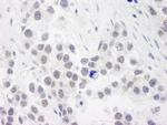 RPA70 Antibody in Immunohistochemistry (Paraffin) (IHC (P))