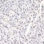 ZEB1 Antibody in Immunohistochemistry (Paraffin) (IHC (P))