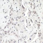 ZEB1 Antibody in Immunohistochemistry (Paraffin) (IHC (P))