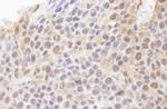 Ubiquitin Antibody in Immunohistochemistry (Paraffin) (IHC (P))