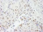 HDAC3 Antibody in Immunohistochemistry (Paraffin) (IHC (P))