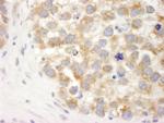 DDX3 Antibody in Immunohistochemistry (Paraffin) (IHC (P))