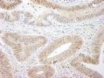 MST1-2/STK3-4 Antibody in Immunohistochemistry (Paraffin) (IHC (P))