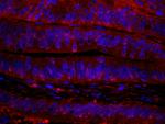 RanBP1 Antibody in Immunohistochemistry (Paraffin) (IHC (P))