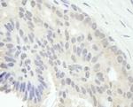 E2F1 Antibody in Immunohistochemistry (Paraffin) (IHC (P))