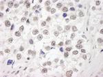 RAP80 Antibody in Immunohistochemistry (Paraffin) (IHC (P))