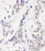 RAP80 Antibody in Immunohistochemistry (Paraffin) (IHC (P))