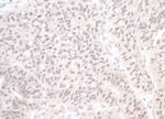 PIMT Antibody in Immunohistochemistry (Paraffin) (IHC (P))