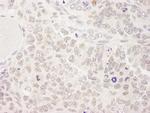 SKIV2L2 Antibody in Immunohistochemistry (Paraffin) (IHC (P))